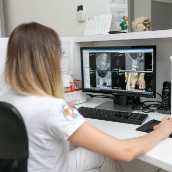 snimanjezuba3d (13 of 18)